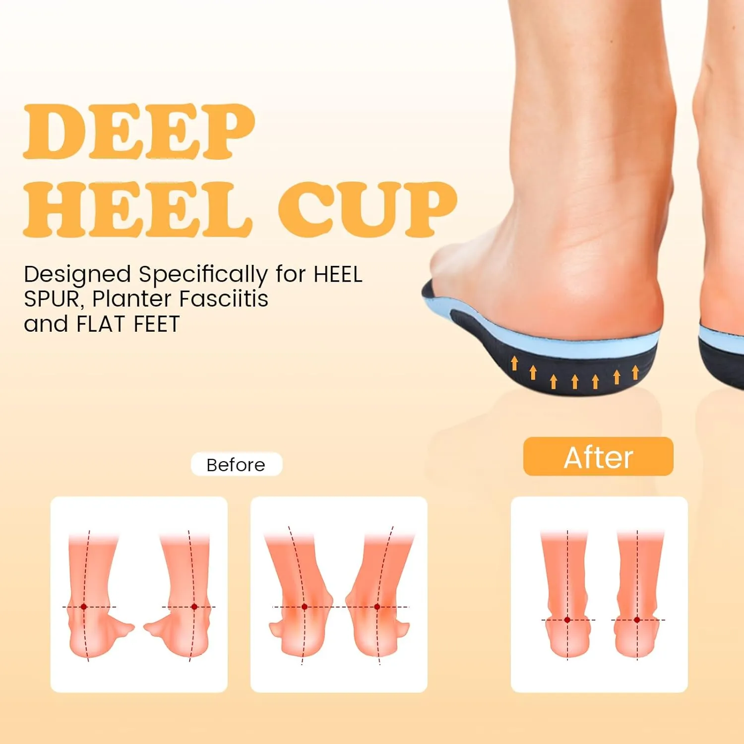 Anti-Fatigue Plantar Fasciitis Shoe Insoles Orthotic Arch Support Inserts for Women Men Flat Feet Work Boot Insoles for Arch Pain Relief (Mens 9-9.5/ Womens 11-11.5)